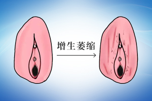 贵阳混合型外阴白斑医院